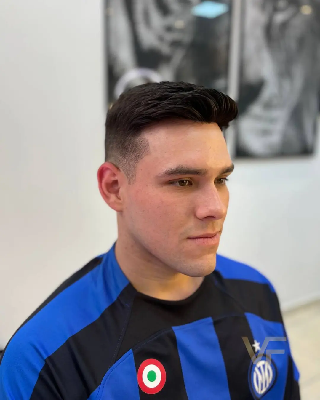 prótese capilar (1)