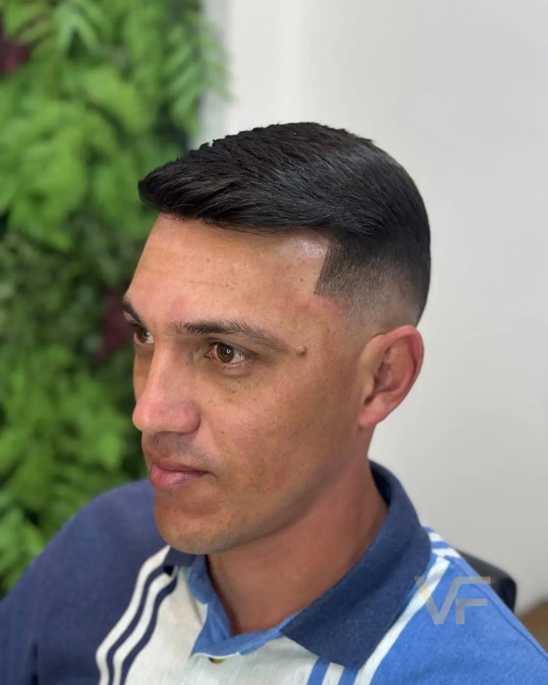 prótese capilar (3)