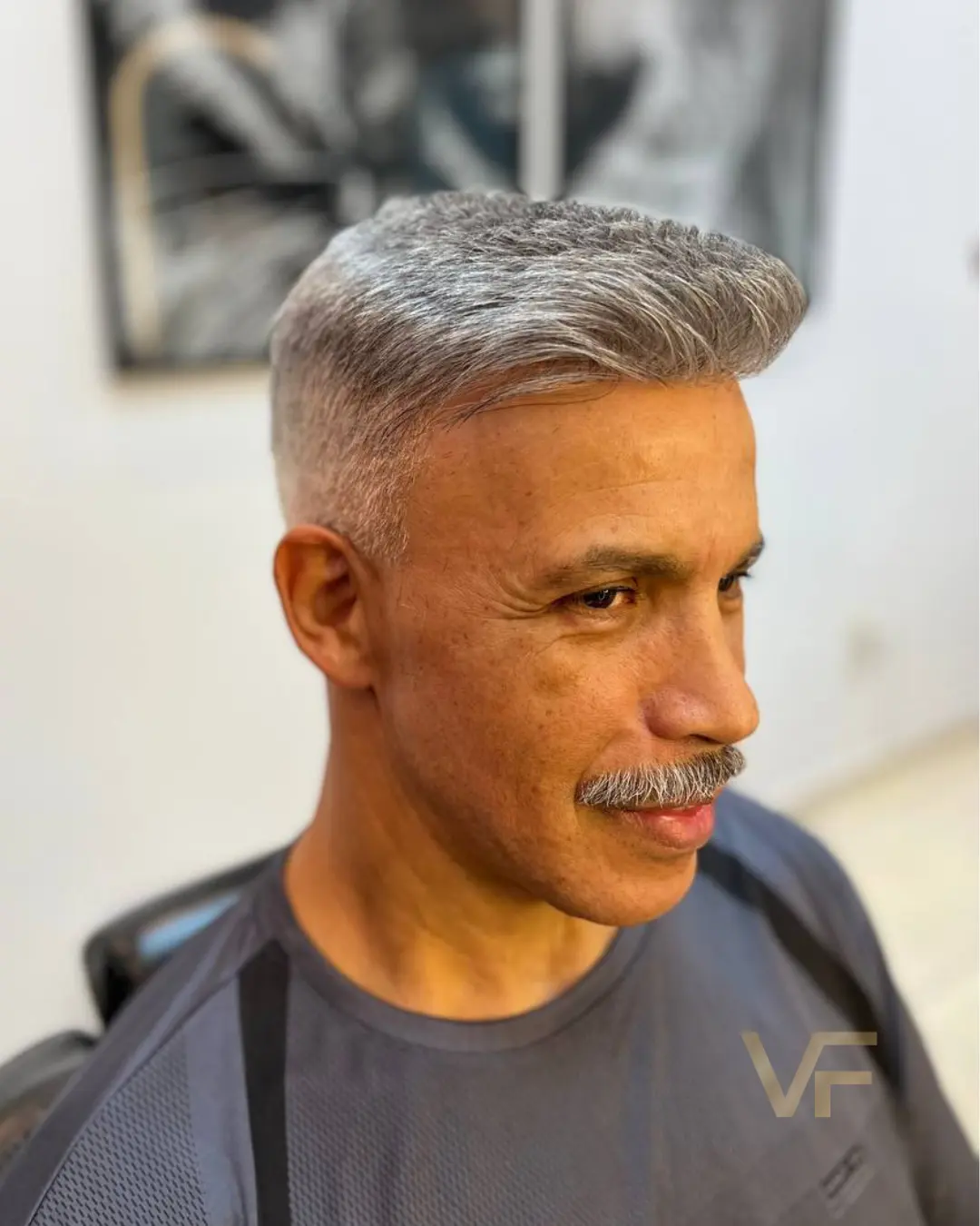 prótese capilar (4)