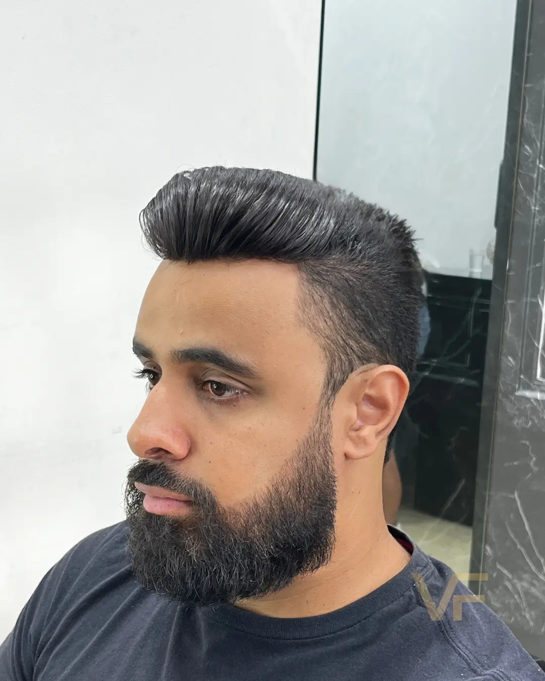 prótese capilar (5)