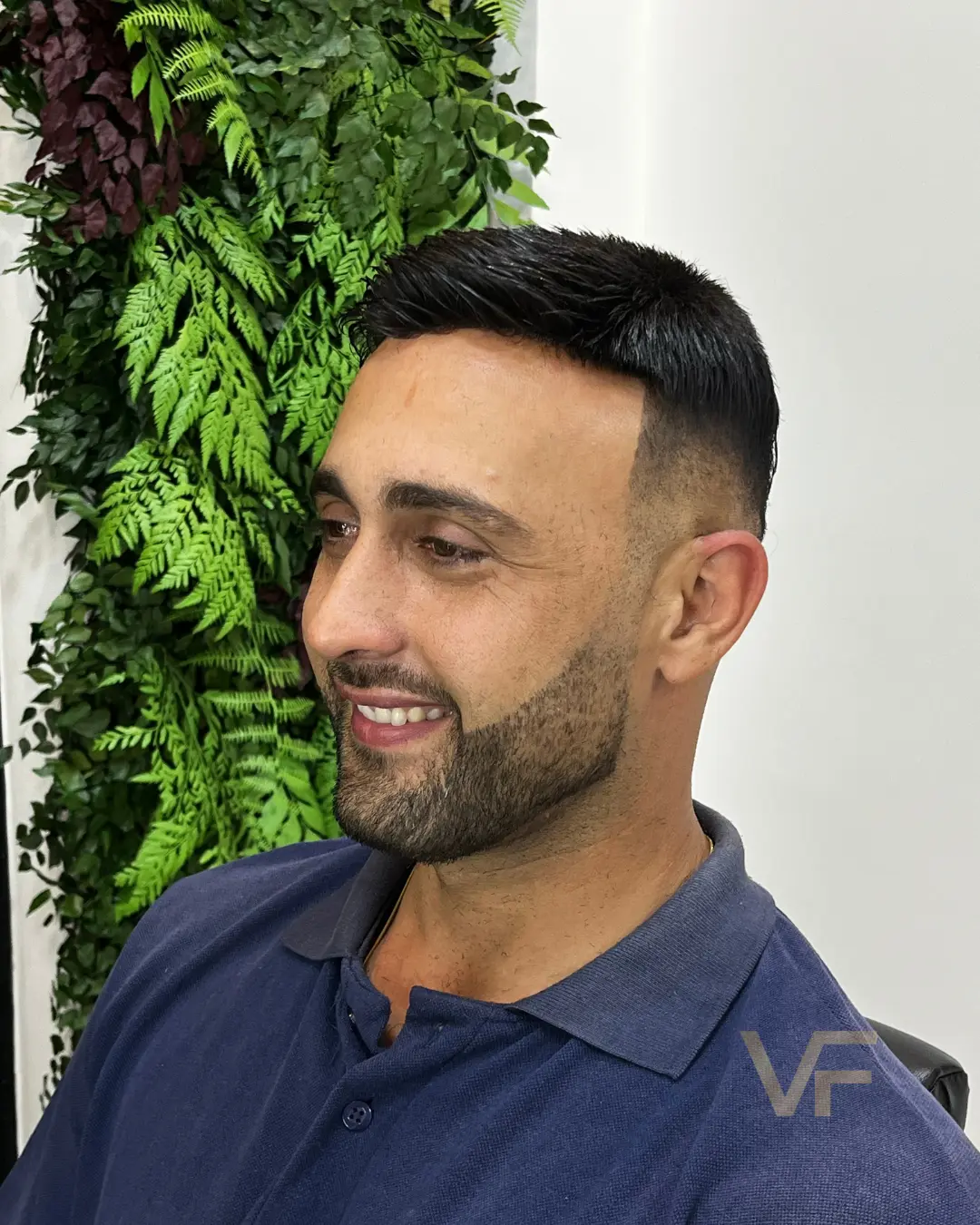 prótese capilar (7)